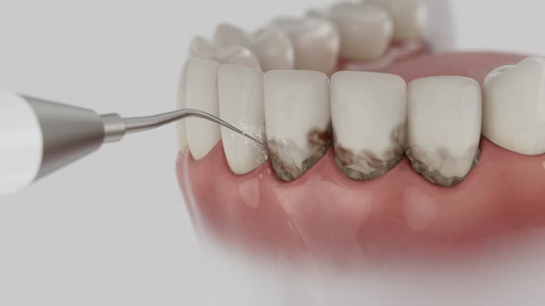 Reliable Dental Implants contractor in Anthony, NM by Smile Center Dentistry